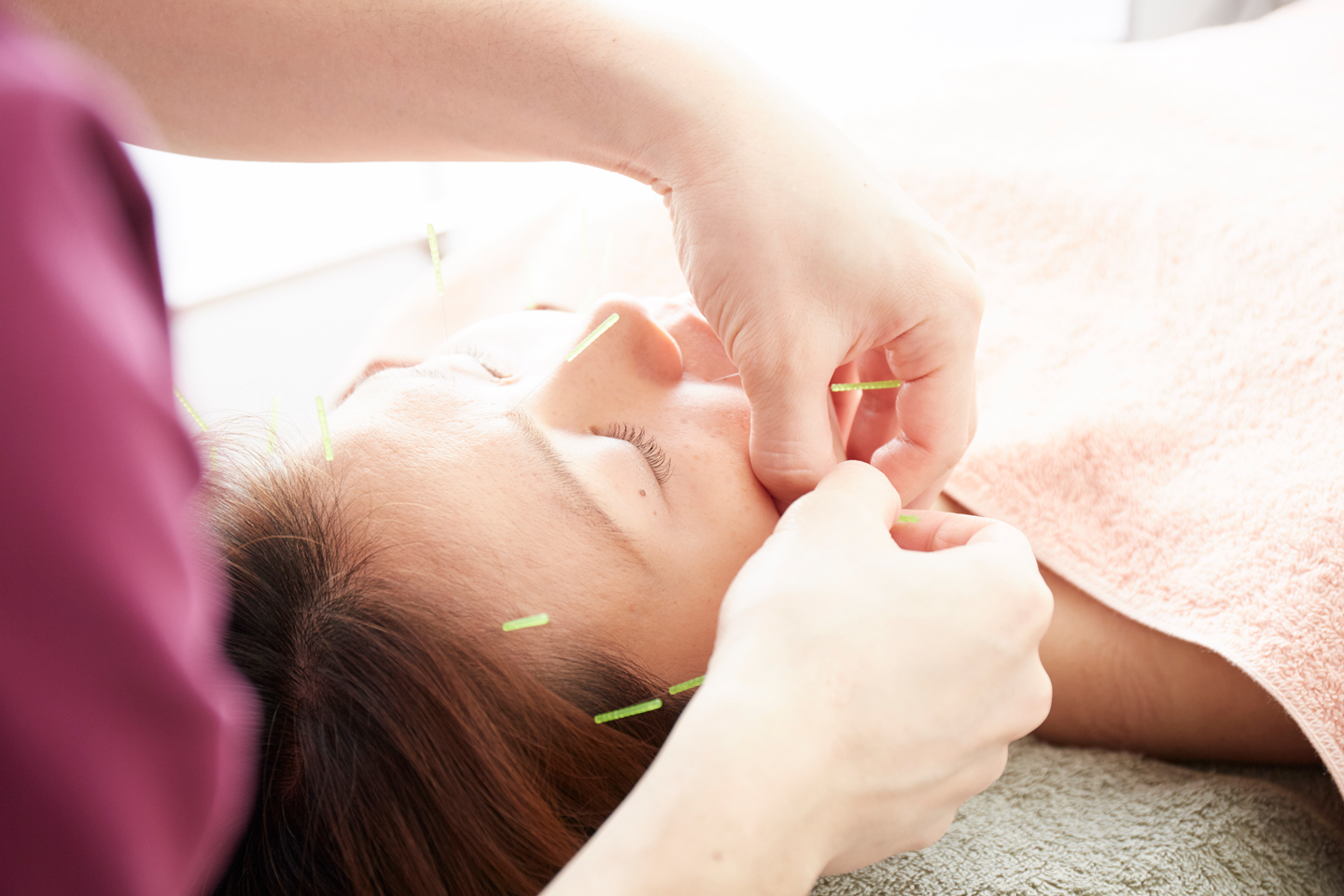 トリガーポイント治療 イメージ