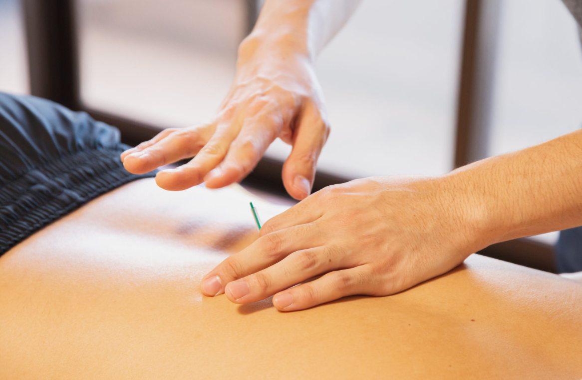 鍼灸とは？
